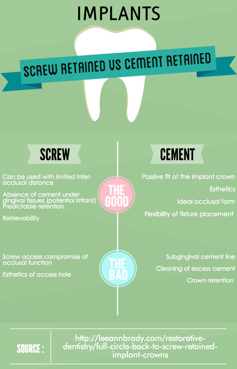 Screw Retained | Cement Retained Implants