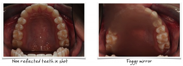 dental photography
