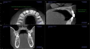 Diagnostic photos for the "missing tooth" case study.