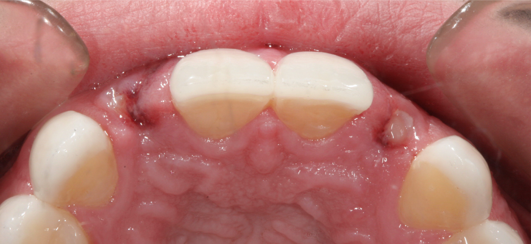 4 Reasons Your Practice is “Missing” Teeth