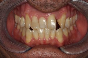 Digital Dentistry Case Before